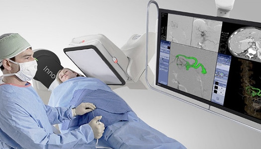 Interventional Accessories