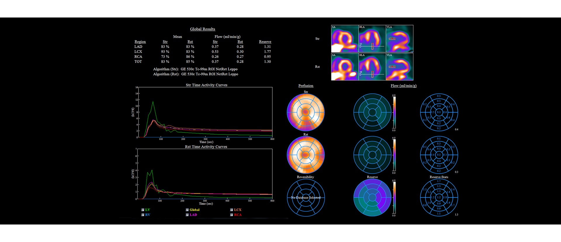 GEHC Xeleris 4 DR Alcyone CFR Image 1 v1