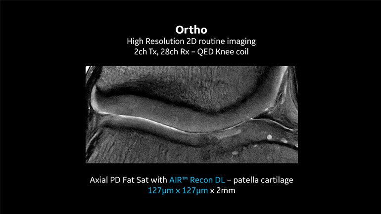 Musculoskeletal MRI Quick Reference Guide for Patients