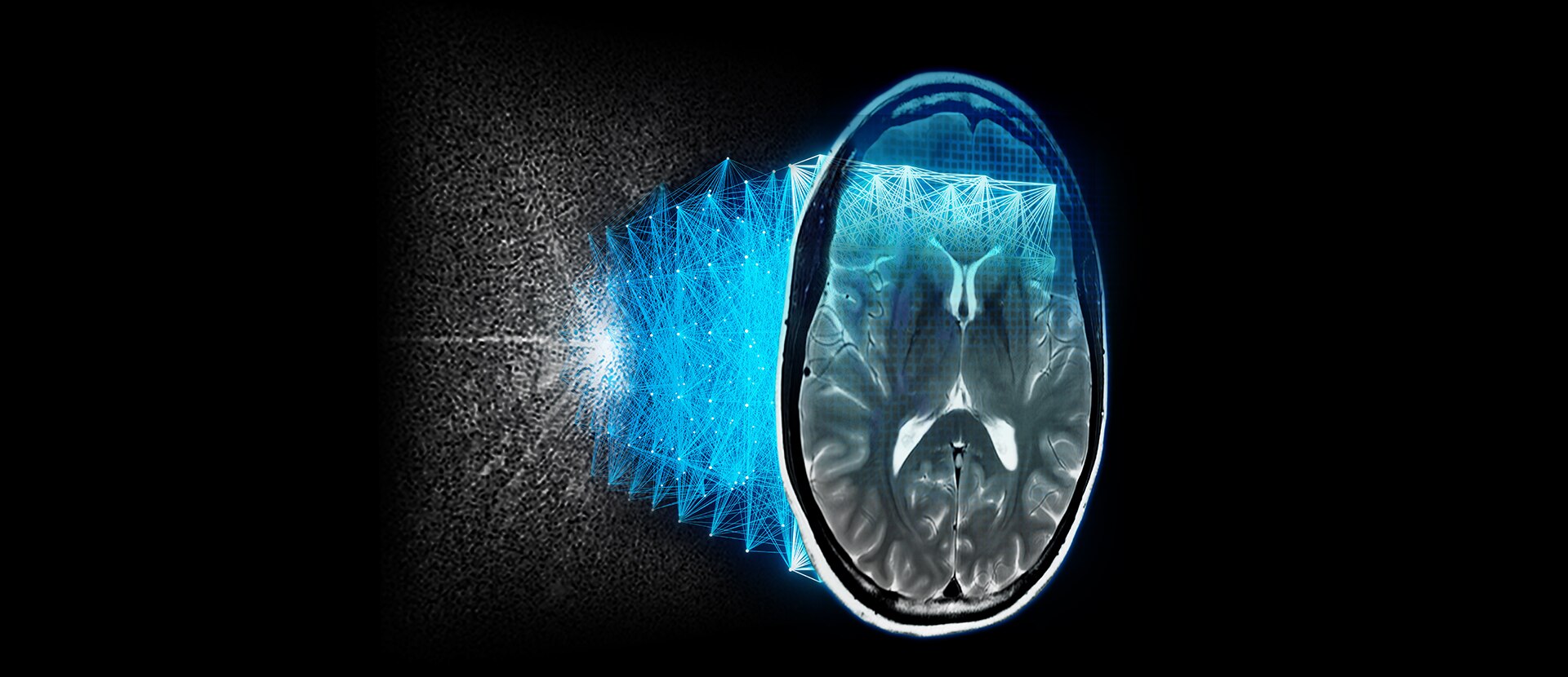 GEHCAIRImageQualityWebpageAIRReconDLImage1