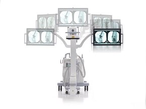 OECOneCFD5rangesofmotion290