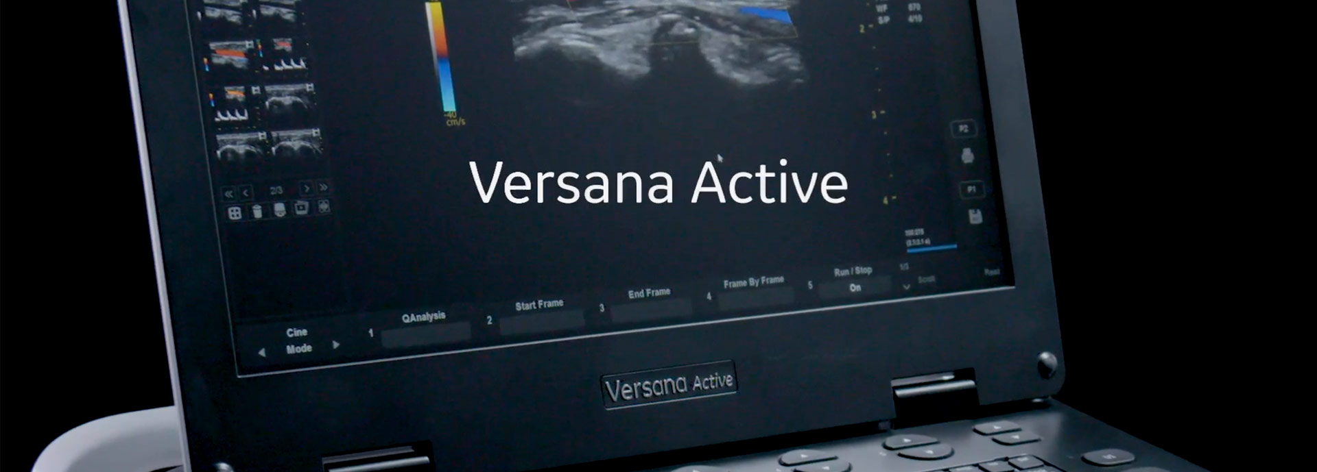 versana-active-video1