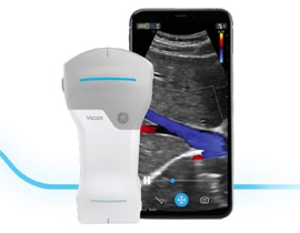 GE Healthcare Vscan ハンディスキャナー Vscan Handheld Ultrasound Machine | GE HealthCare (India)