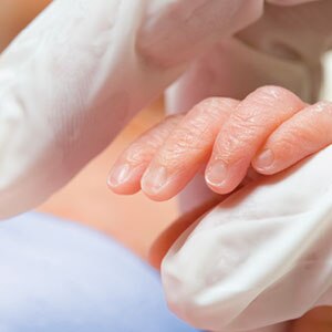 Panda™ Warmers | GE Healthcare