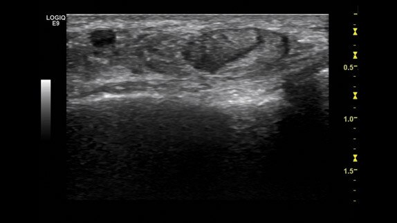 hotspot tours-logiq e9-cross-beam_jpg