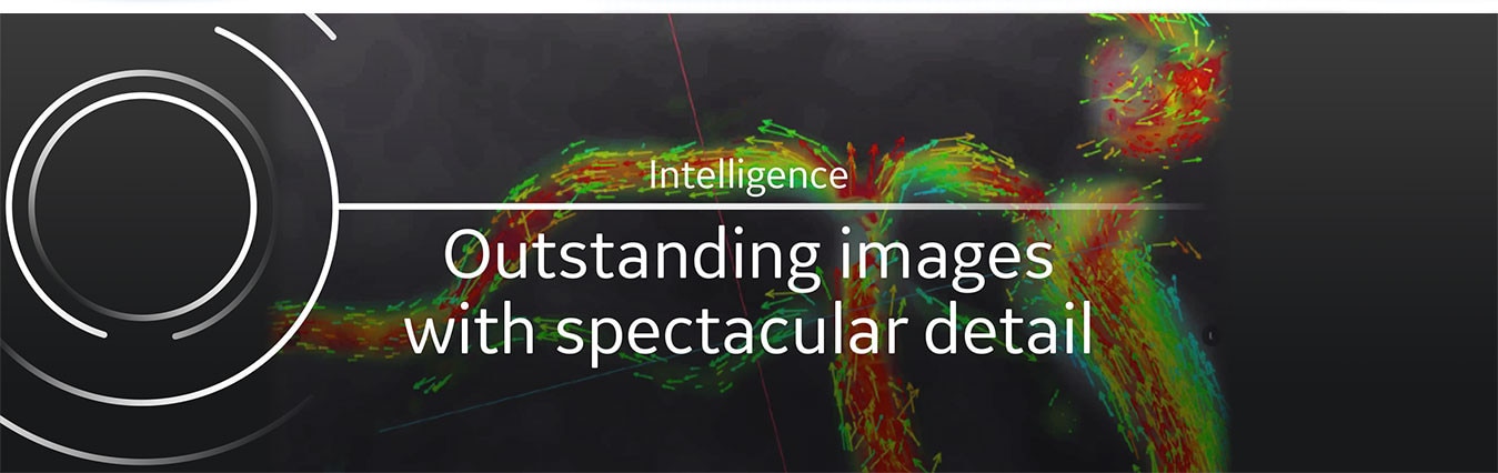 magnetic-resonance-imaging-signapremier-banner4