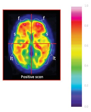 positive scan
