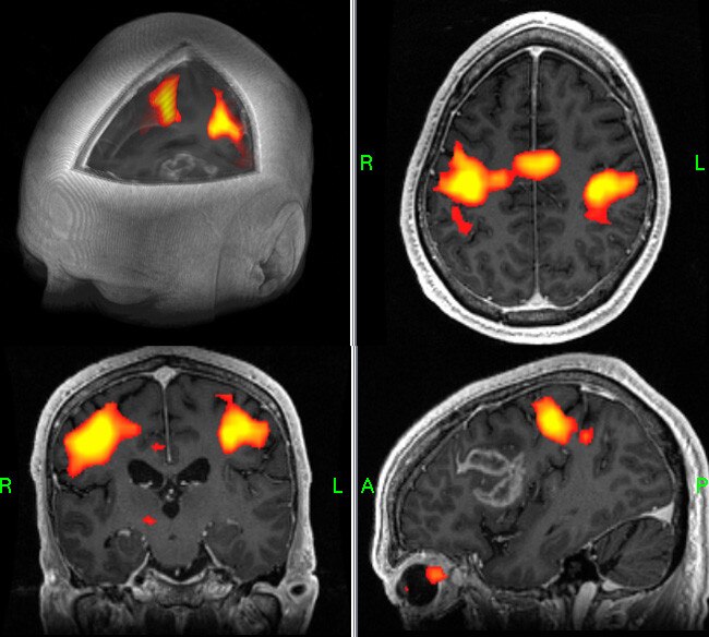 GE Healthcare Brainwave